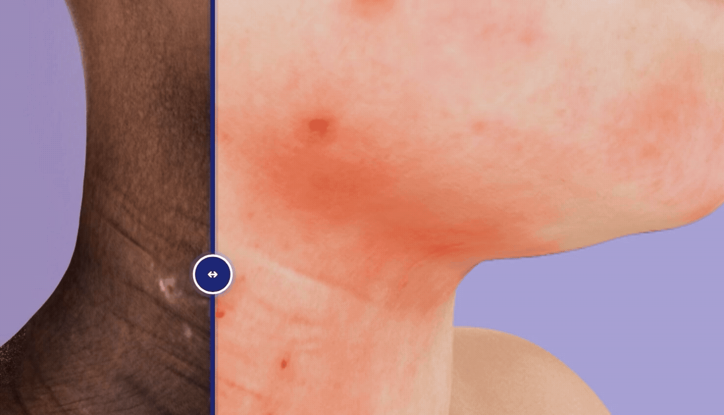 Animation of the compare slider feature