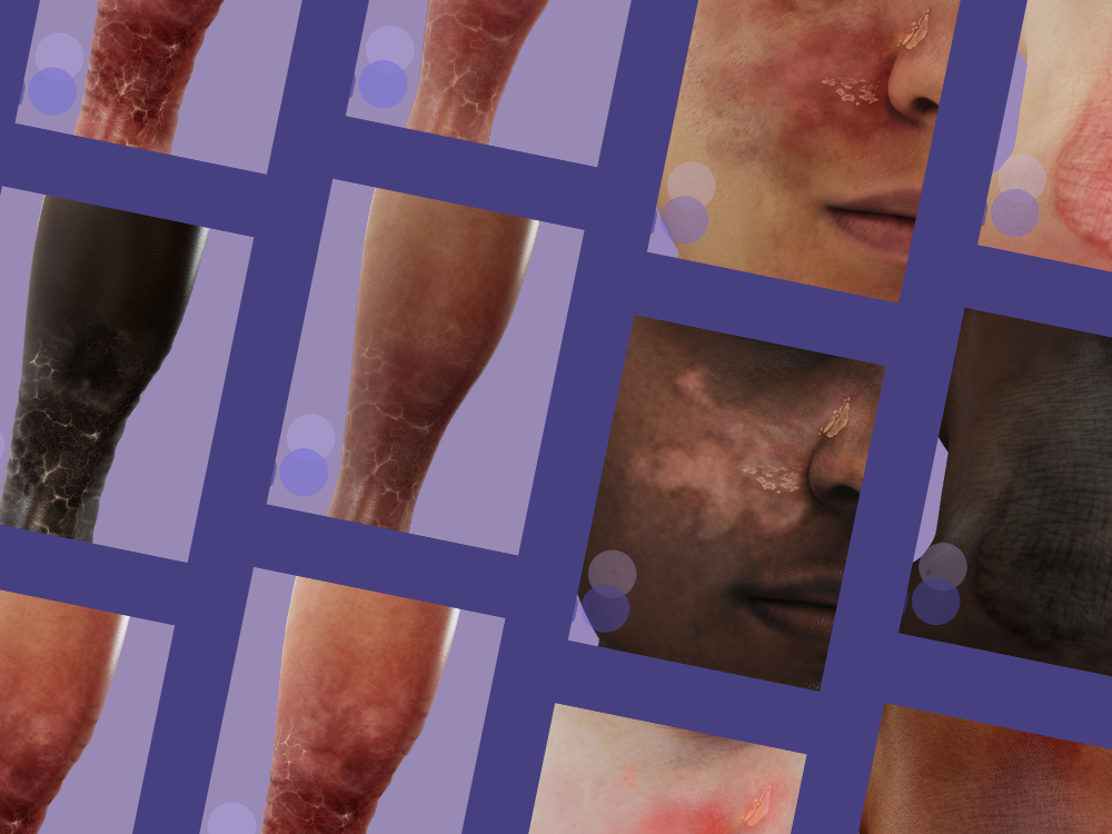 Animation of the TONO image gallery