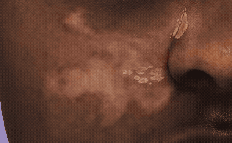 Animation of the TONO viewer controls